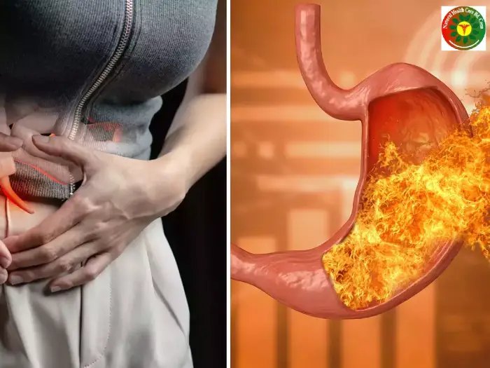 15 Common Causes & Home Remedies for Gas and Acidity in the Stomach